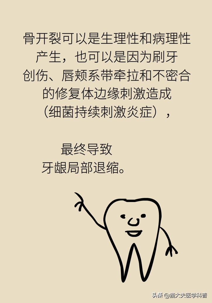 牙根暴露了该怎么刷牙,牙根治疗后可以刷牙吗