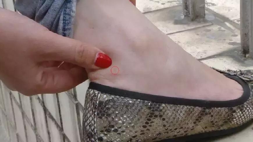 红火蚁出没村民被咬致休克,红火蚁入侵这里多人被咬伤