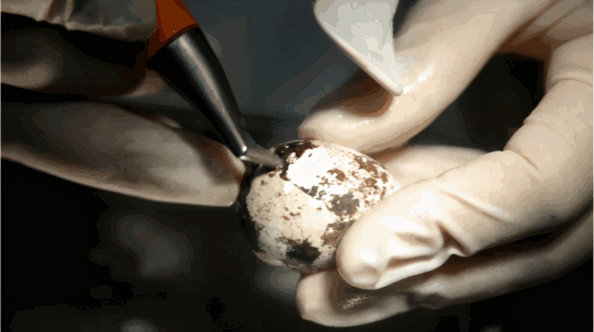 洗牙之后牙缝敏感,洗牙疼不疼