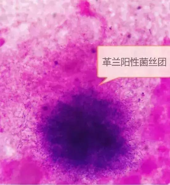 他摸了出土*物文**，然后住院八次