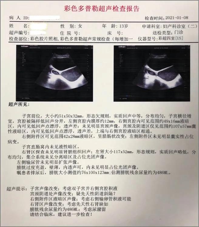 手术新秀|孙思源副主任医师：12岁患者阴道斜隔切除术