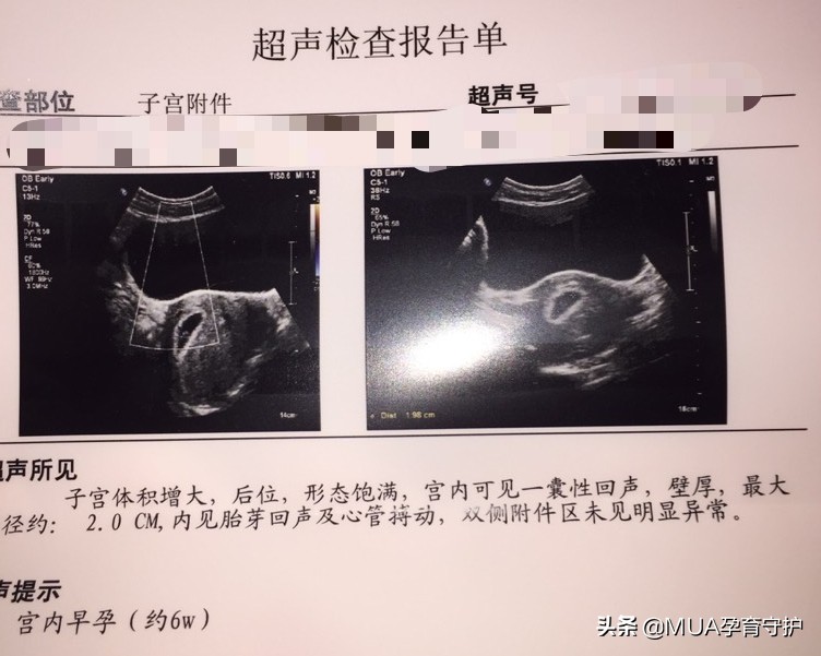 如何确认自己是否怀孕？教你5种方式轻松确认