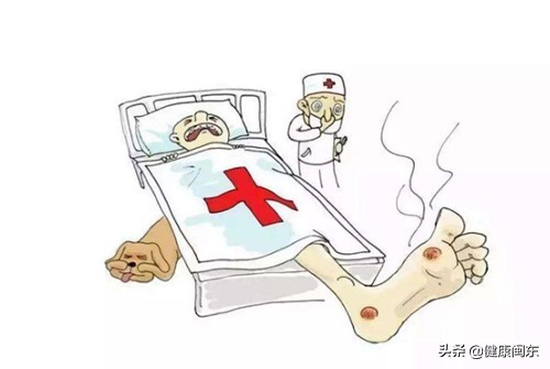 福安市67岁大伯穿橡胶鞋起水疱敷草药导致皮肤及筋膜组织坏死