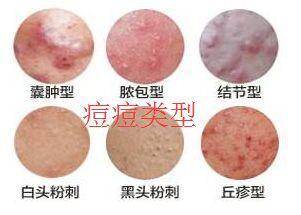 出现红色斑点是什么原因,4月份脸上起红点是什么情况