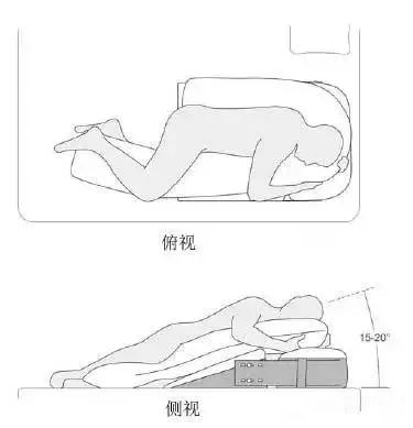 反酸烧心嗓子有异物感吃什么药,喉咙烧心反酸是咋回事