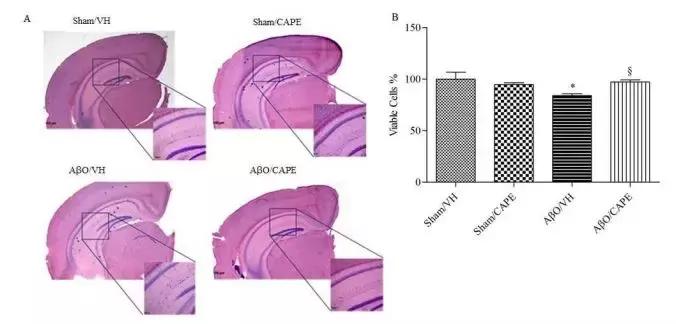 阿尔茨海默论文,检测阿尔茨海默症最新研究