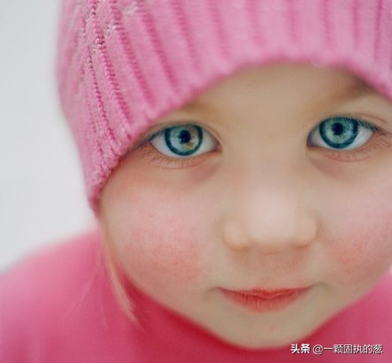 皮肤干燥手足干燥,宝宝皮肤干燥怎么办用什么方法