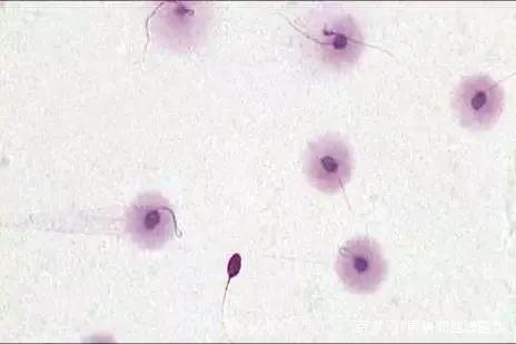 精子dna碎片率的简称,精子dna碎片一般为多少