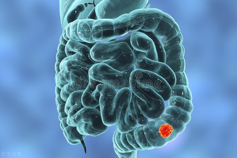 直肠癌的6个早期症状怎么引起,导致直肠癌出现的五大原因介绍