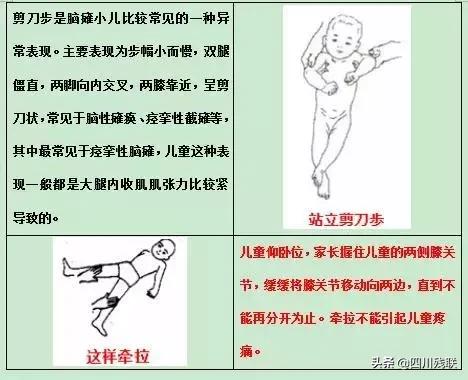 四川脑瘫康复训练有效果吗,成都脑瘫恢复中心