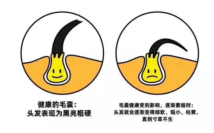 有些人年纪轻轻就有白头发为什么,年纪轻轻就白头发多了