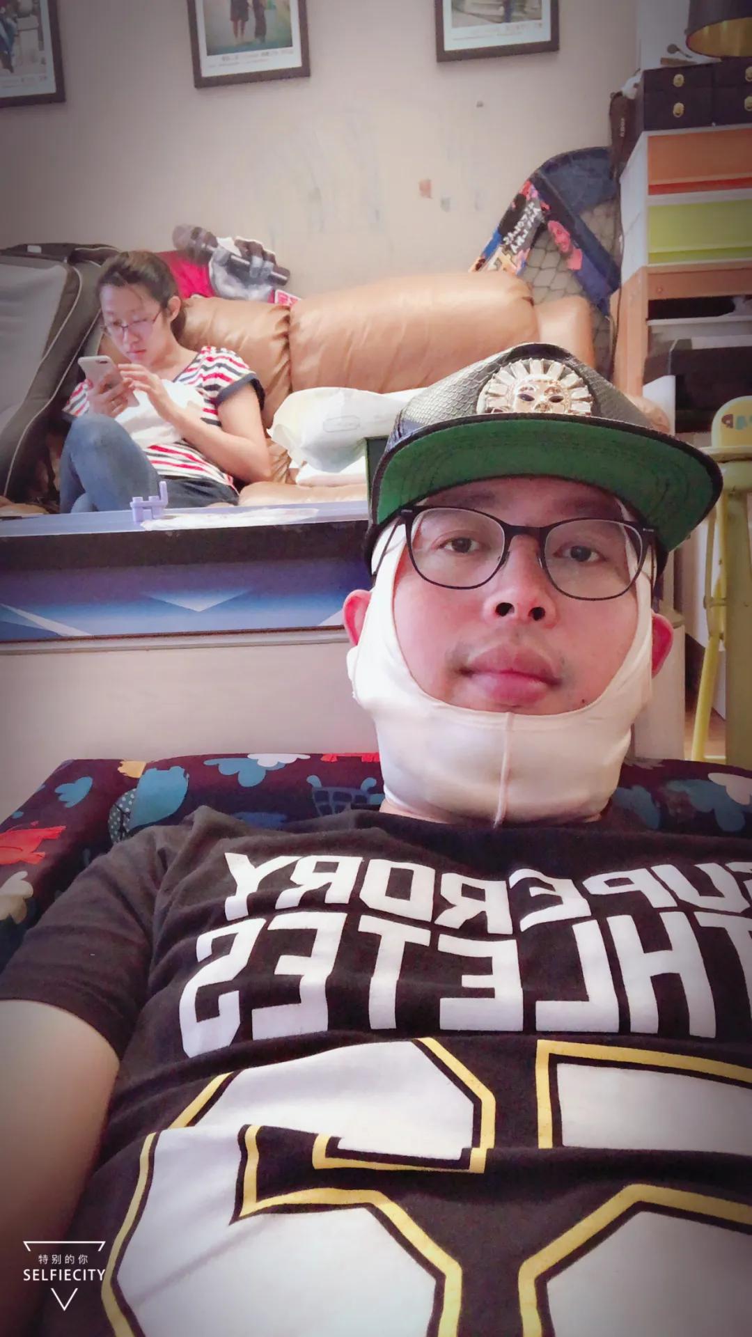 抽脂亲身经历回忆,抽脂血泪史