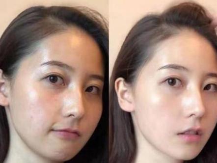 这款淡斑精华真的好用吗,国货仁和淡斑精华液