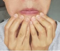 面部肌肉松弛怎么锻炼变紧,面部皮肤松弛锻炼法