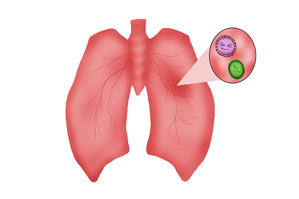 痰液颜色黄黄的,是怎么回事?