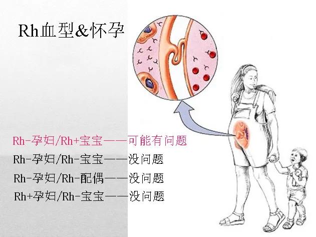 rh血型熊猫血全国有多少人,rh阴性熊猫血哪种最稀有