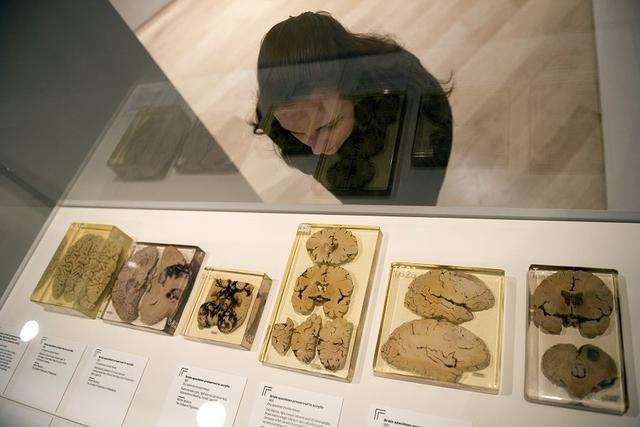 是非凡大脑让爱因斯坦成为物理学家，还是物理改变了他的大脑？