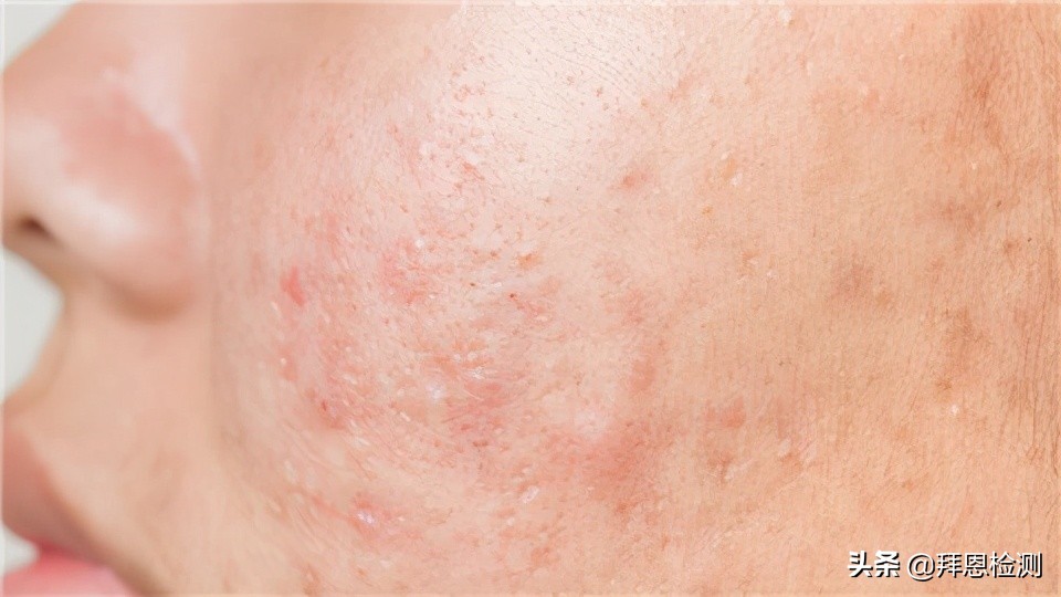 怎么可以检测化妆品里有没有激素,如何检测化妆品是否含有激素