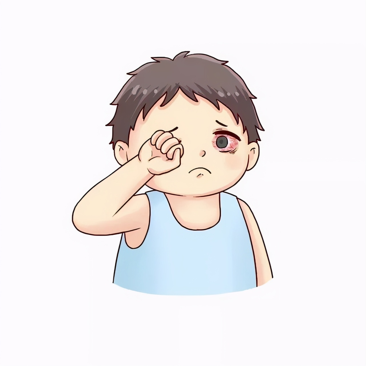 眼睛春季过敏性结膜炎,春季眼睛痒当心急性出血性结膜炎