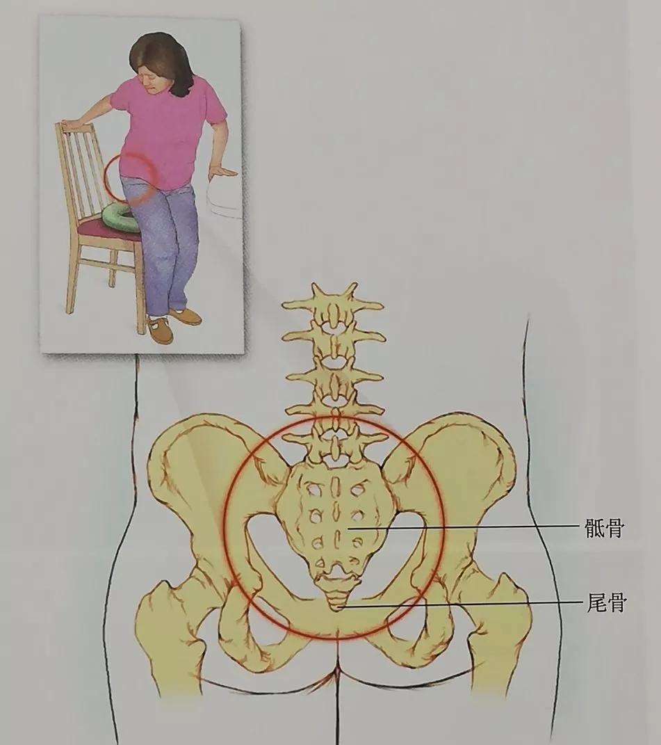 收藏综合征,男性骨盆疼痛综合征