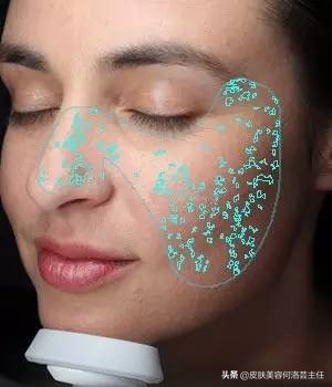 visia皮肤检测仪,visia皮肤检测报告数值越大越好吗