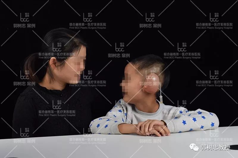 小耳畸形那些事儿（九）扩张器回家注水可行吗？