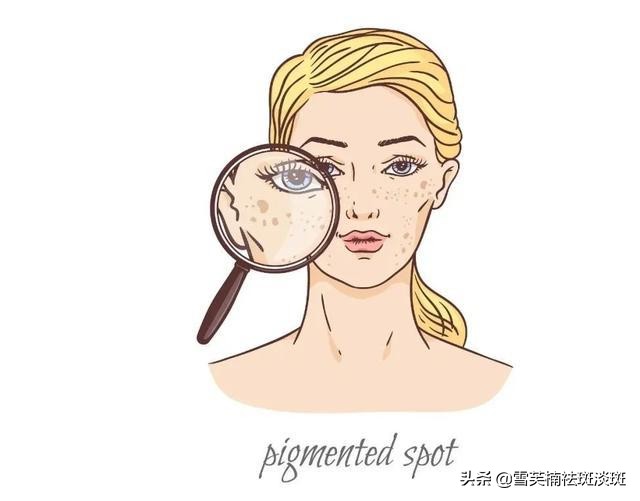 去斑点的最好方法淡斑精华,去斑点的最好方法淡斑