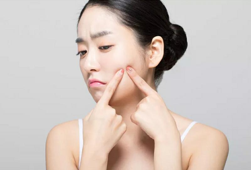 热天非常热然后长了痘痘是什么痘,夏天长痘怎么办教你轻松赶跑痘痘