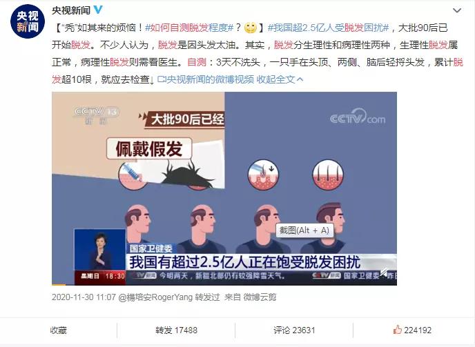 秃如其来专家教你自测脱发,u字型脱发怎么补救