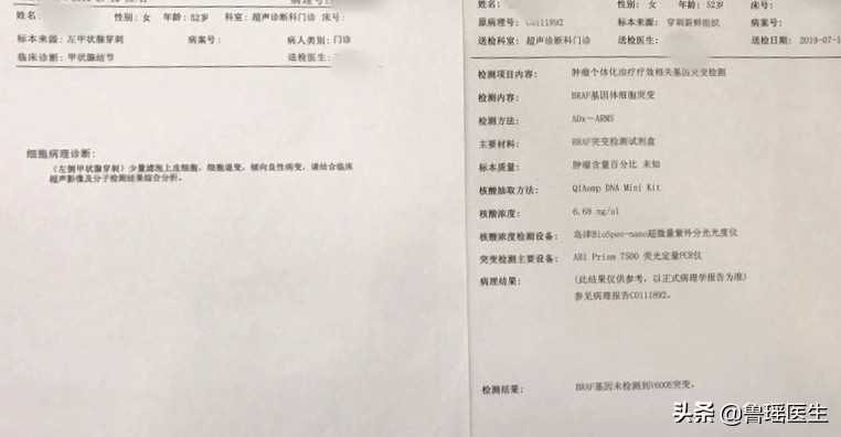 “大夫，我刚做完甲穿提示结节是良性，为什么还要让我做？”