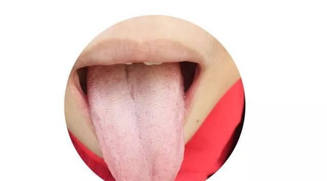一招教你看舌苔图片,一张图看懂孩子学习