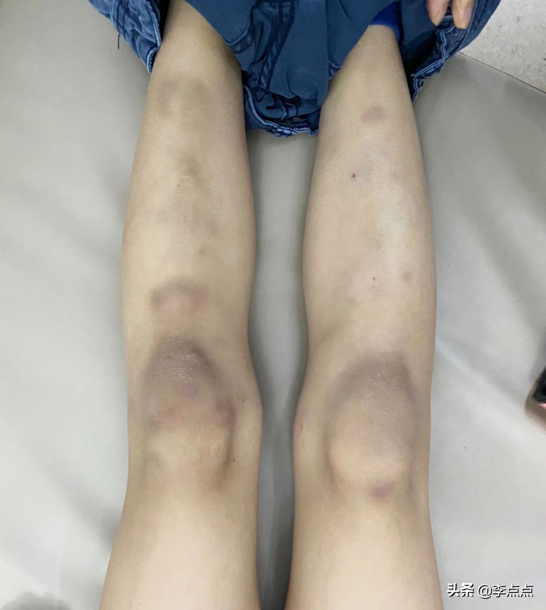 小动作多好动是多动症吗,好动不等于多动症儿童调皮