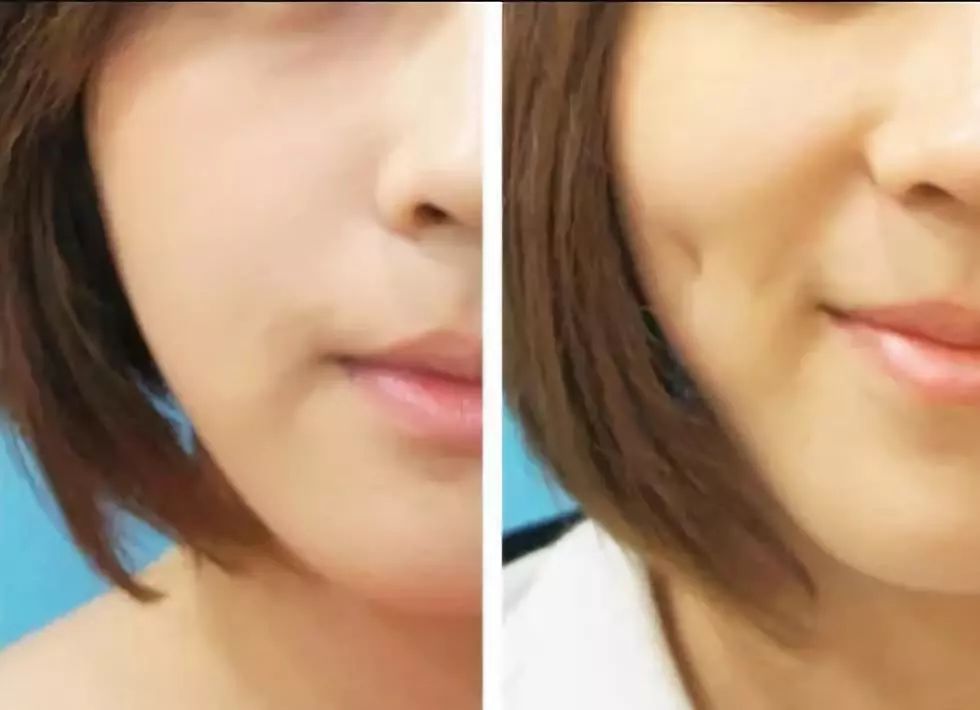 杨紫脸上小酒窝,杨紫林俊杰现场演唱会