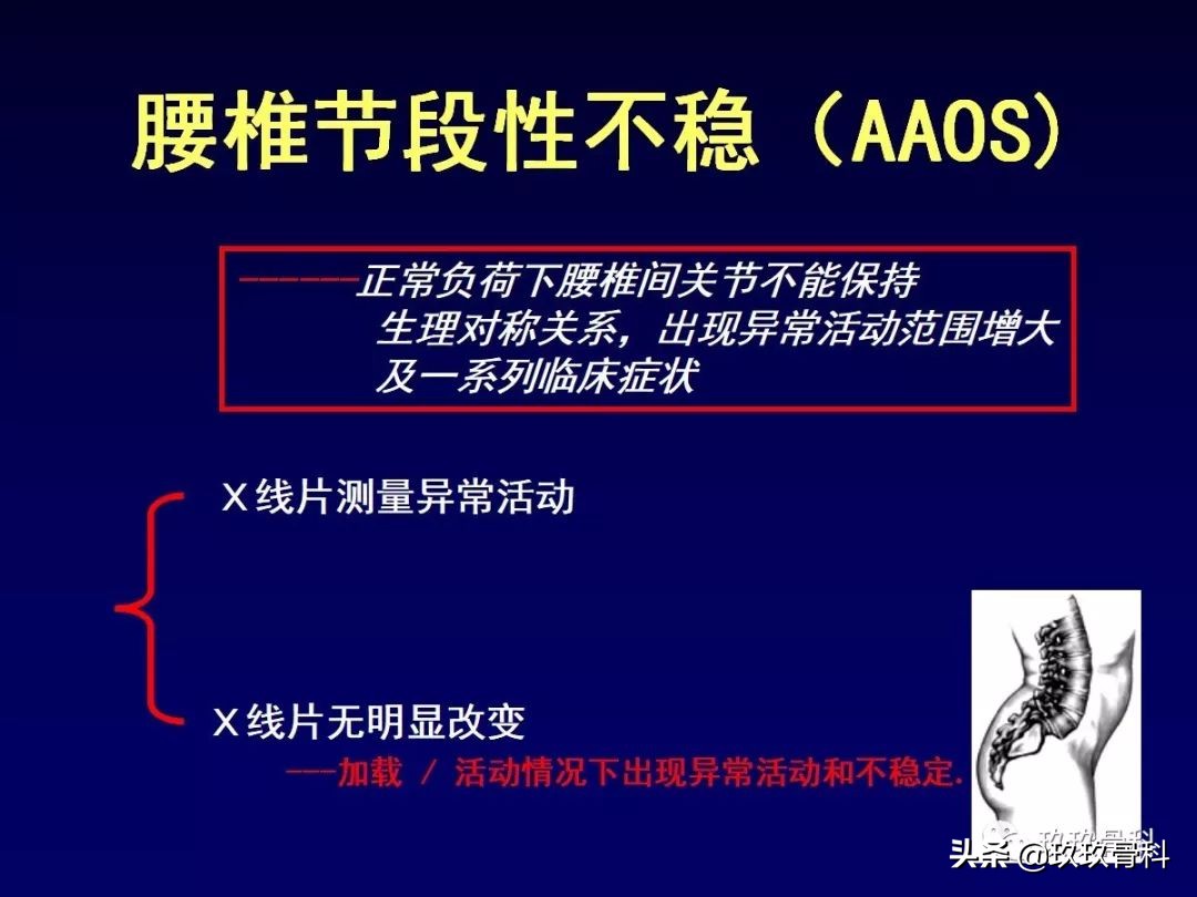 腰椎不稳最坏的结果,腰椎不稳的最佳治疗方法