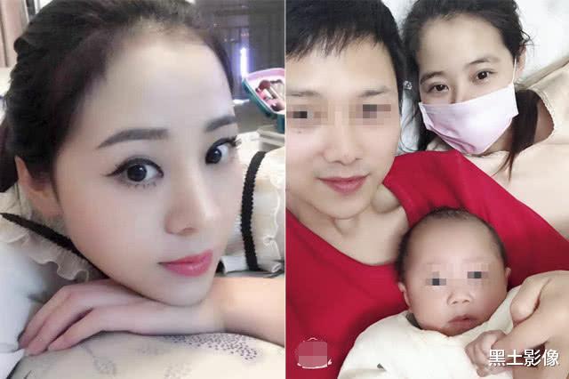 美女为生娃导致面部畸形,流浪街头自救:想活久一点,陪儿子长大