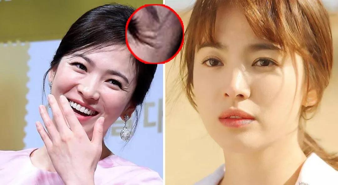 玻尿酸睡眠眼罩,日本去黑眼圈最好的产品