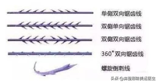 为什么医生都反对线雕隆鼻,到底要不要做线雕隆鼻