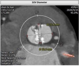 罗建方医生怎么样,罗建方教授