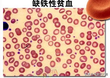 产后怎样矫正身材,产后如何快速打造身材