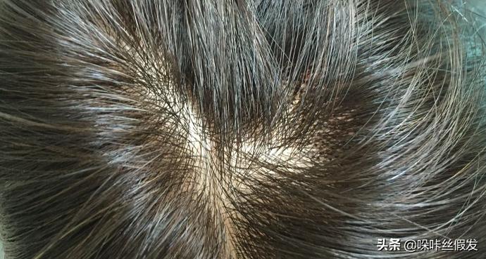 仿真头皮和生物头皮的区别,仿真头皮是什么