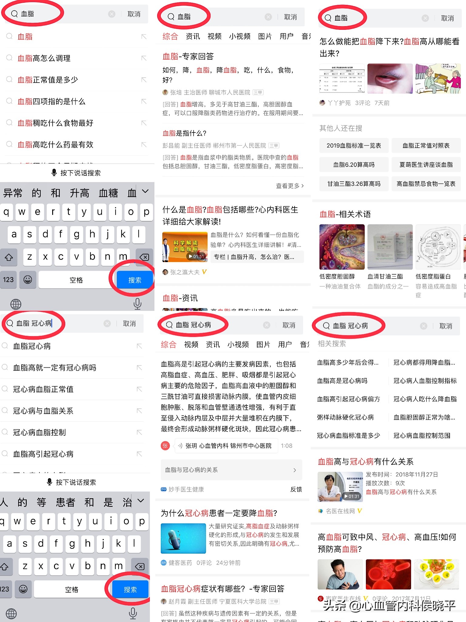 中年女性单纯的血脂高有什么办法,更年期女性高血脂症