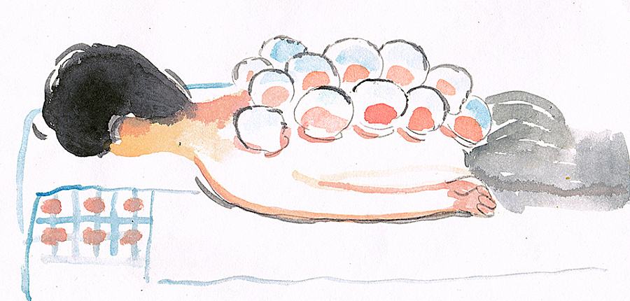 拔罐舒服吗有什么用,拔罐很舒服