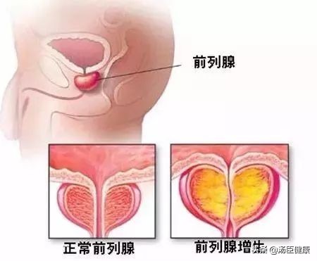 飞机上医护人员为病人吸尿,飞机上吸尿救人医生将获奖励