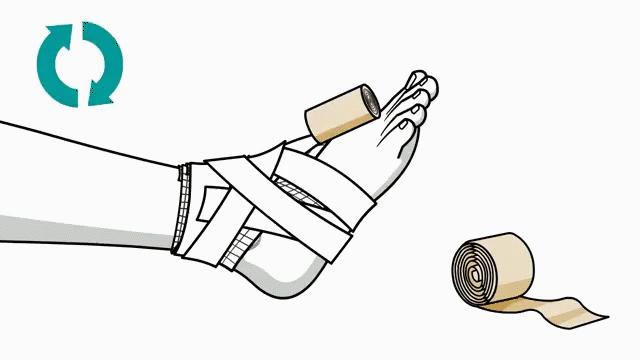 崴脚了用什么加压包扎,打篮球崴脚加压包扎