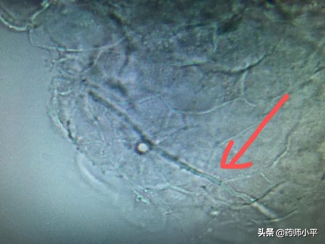 股癣大腿根痒怎么治,大腿内股癣瘙痒用什么药膏