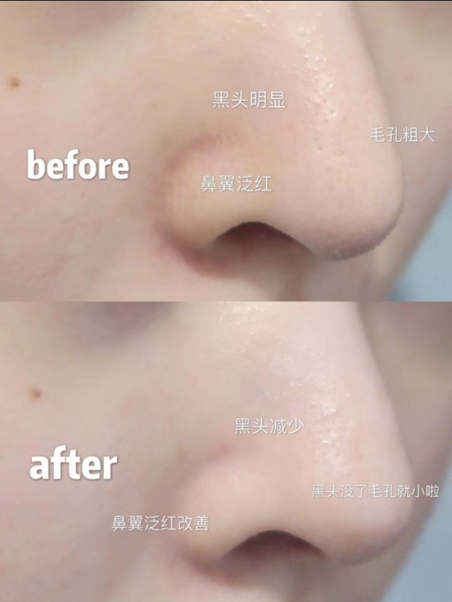 科颜氏男士产品怎么样,科颜氏十大必买护肤品