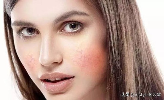 对防腐剂过敏该选什么护肤品,防腐剂过高导致过敏怎么修复