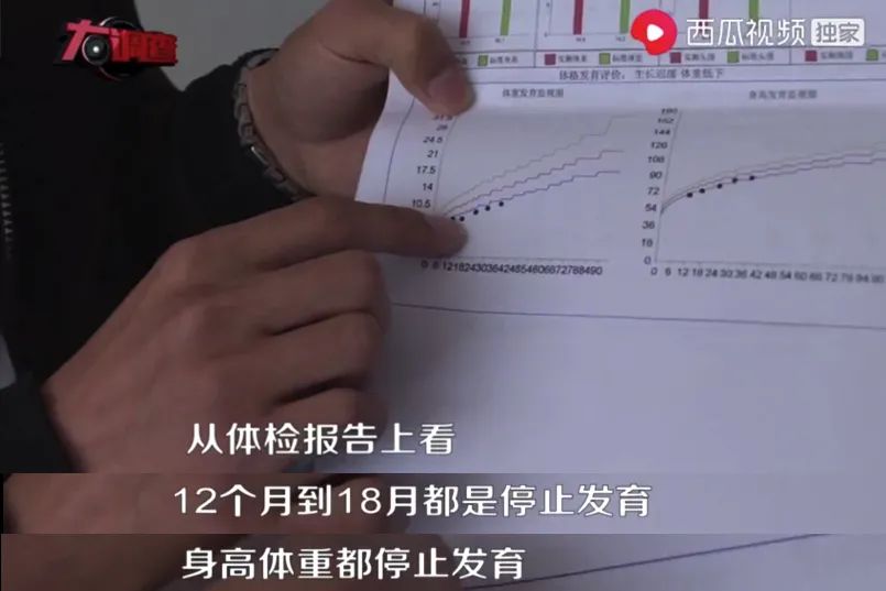 湖南大头娃娃 (湖南把饮料当奶粉喝出大头娃娃)