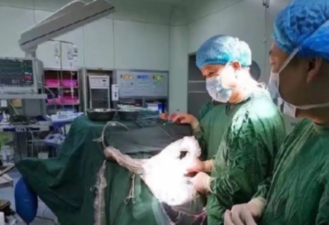 女孩脑中的寄生虫,20岁女孩脑袋有寄生虫后续