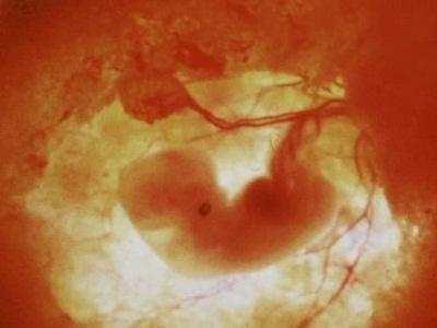 受孕着床有什么感觉会发烧吗,受孕着床的10大征兆